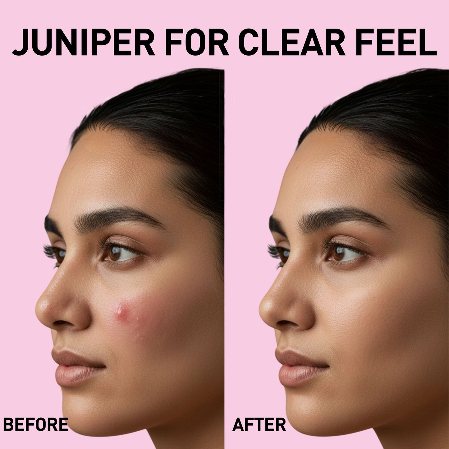 W2 Raspberry Skin Toner