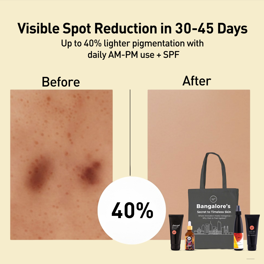 Bangalore Pigmentation Kit