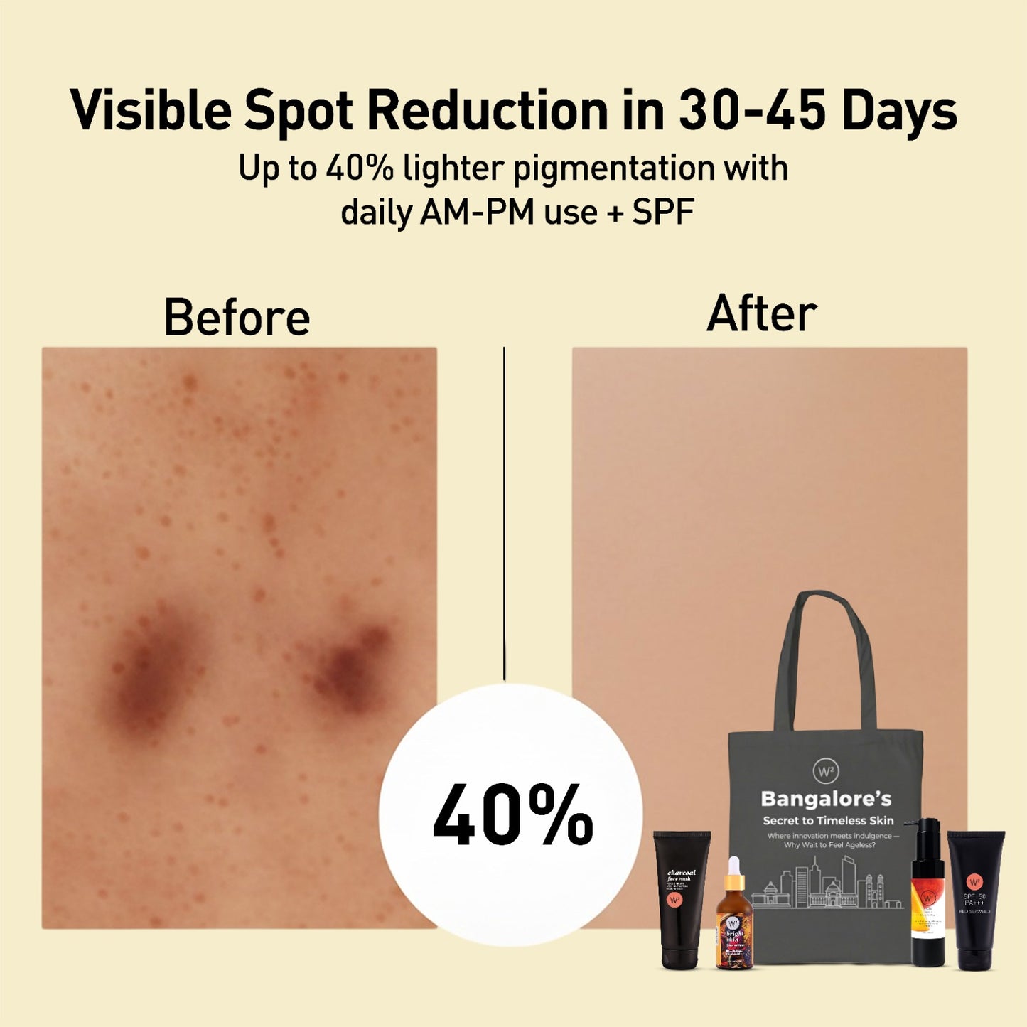 Bangalore Pigmentation Kit