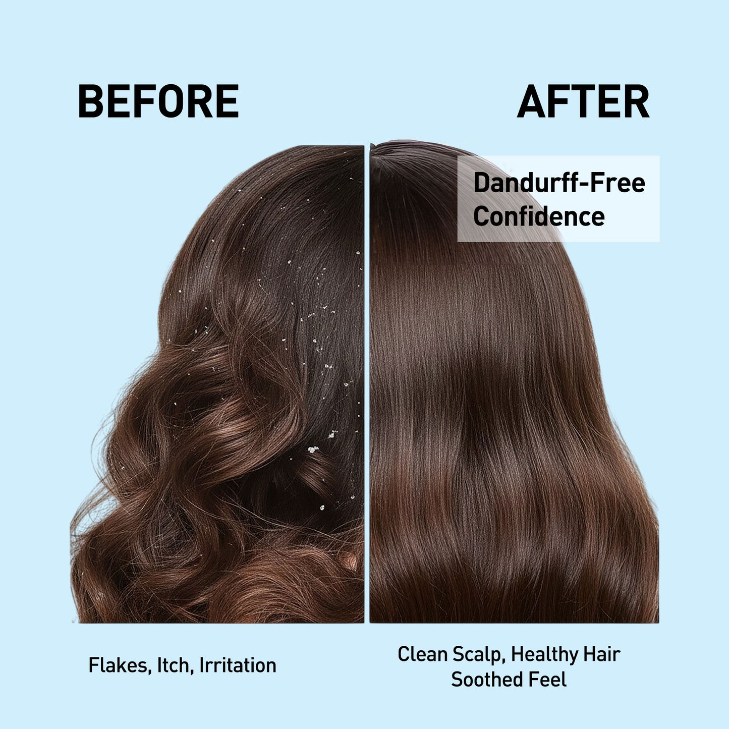 Anti Dandruff Shampoo