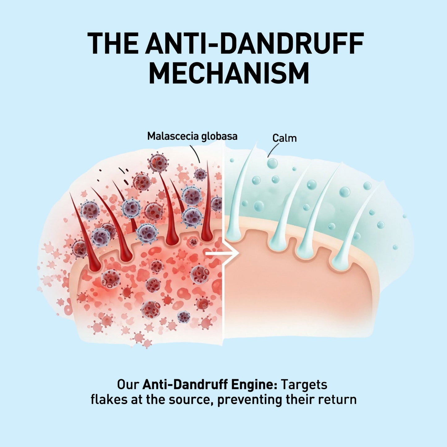 Anti Dandruff Shampoo
