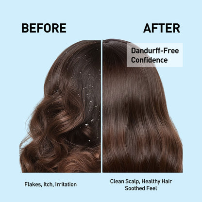 Anti Dandruff Shampoo