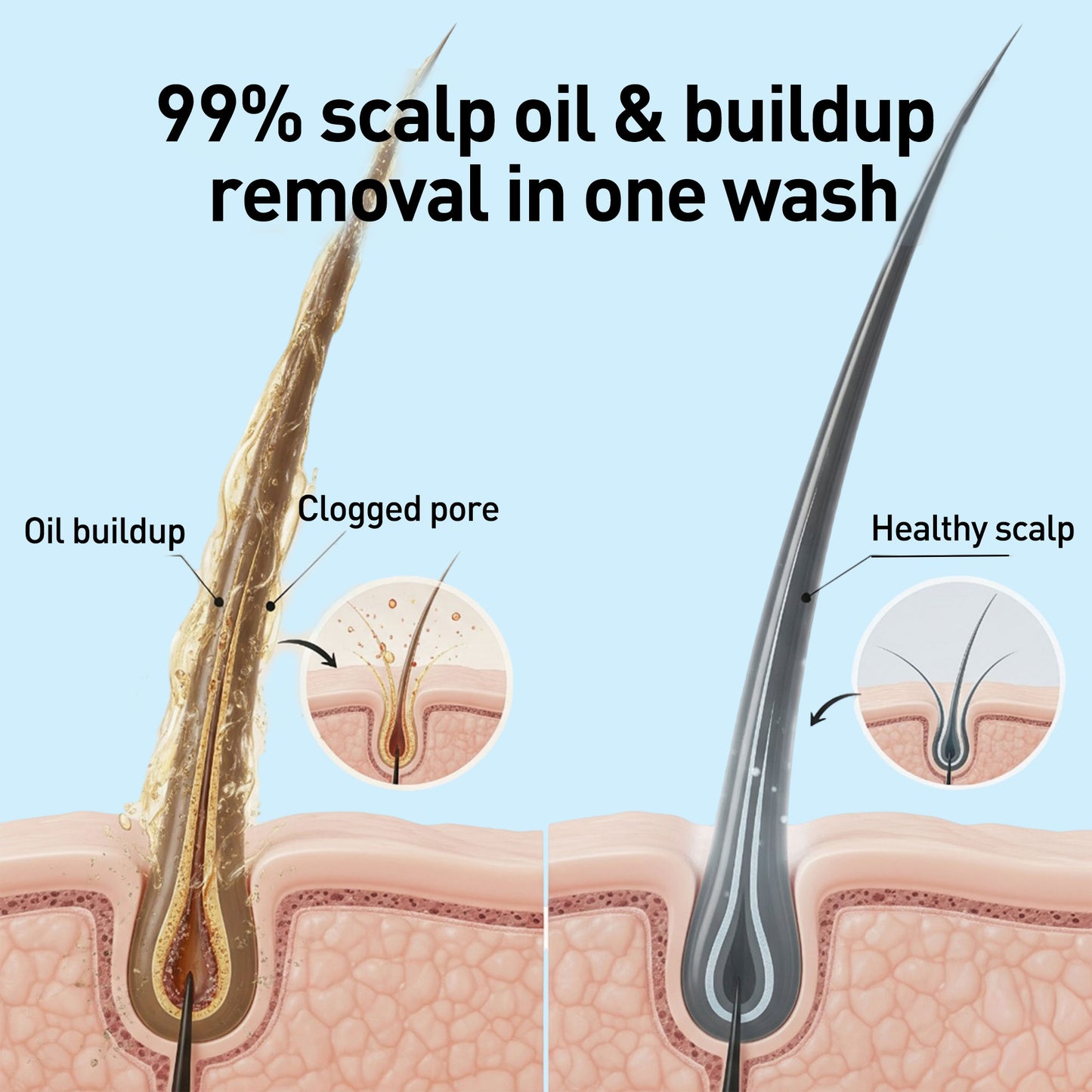 Anti Dandruff Shampoo