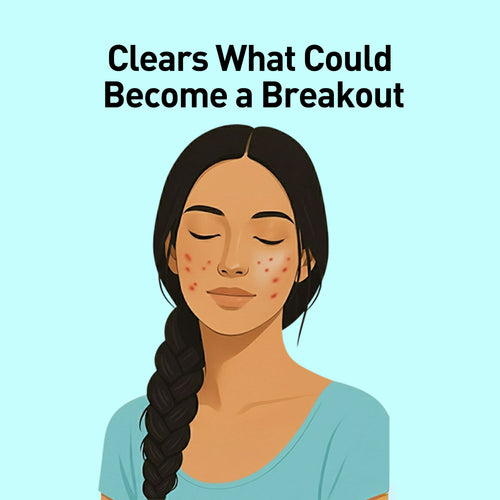 Illustration of a woman with acne on a light blue background with text.