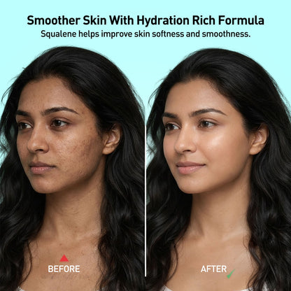 W2 Rice Water Day Hydra Gel- 80g