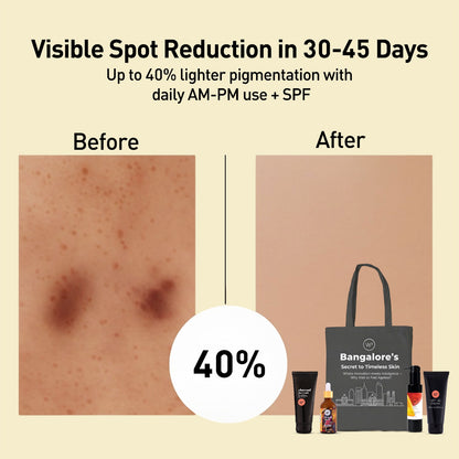 Bangalore Pigmentation Kit